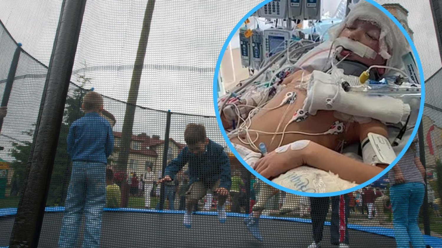 Wypadek na trampolinie. 8-latek walczy o życie