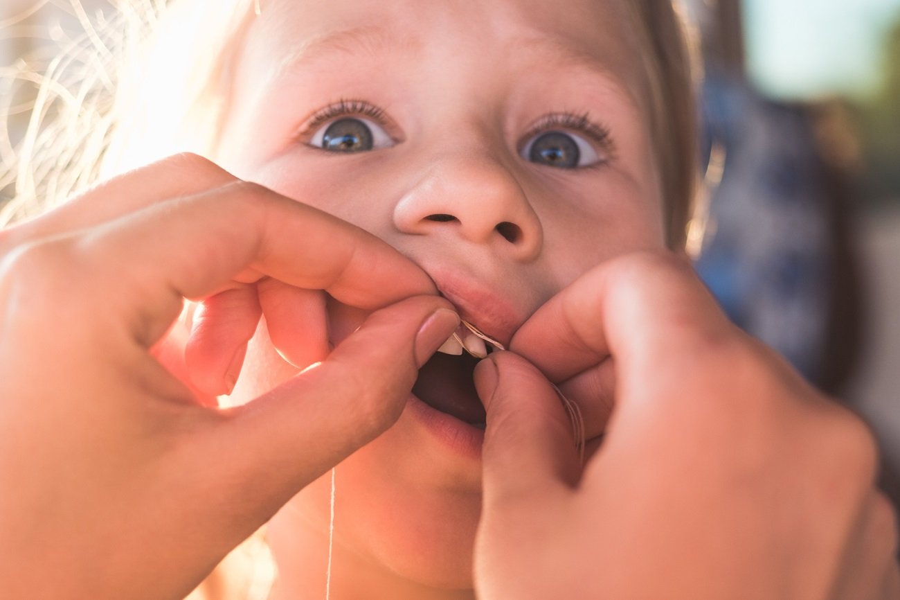 Chciał "kreatywnie" wyrwać dziecku ząb. Gdzie ten ojciec miał rozum?