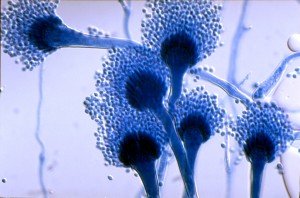Aspergillus fumigatus